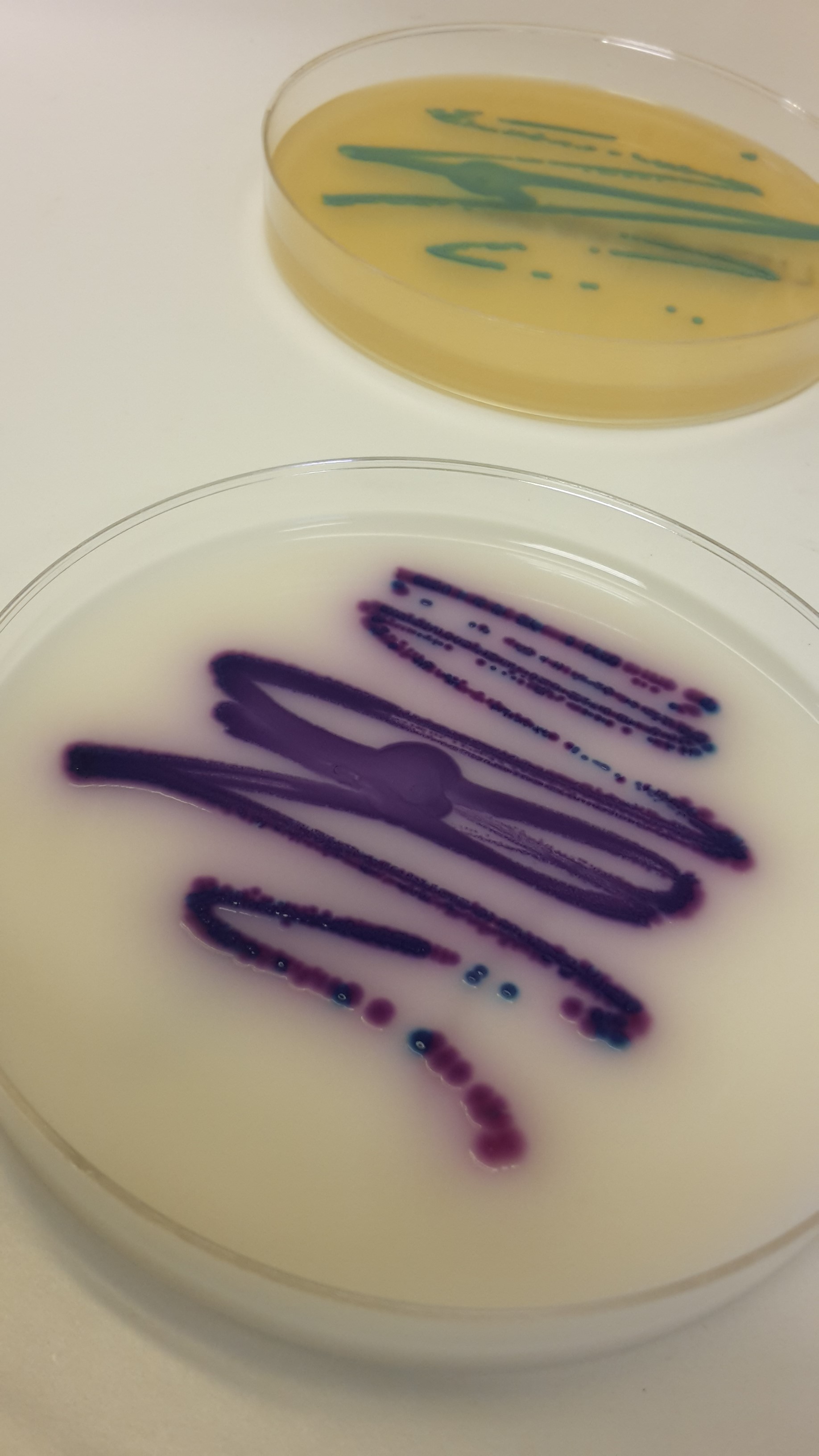 Salmonella og Listeria dyrket på skål